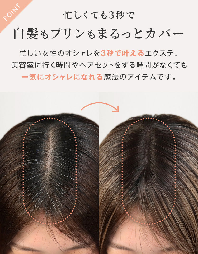 トップエクステンション