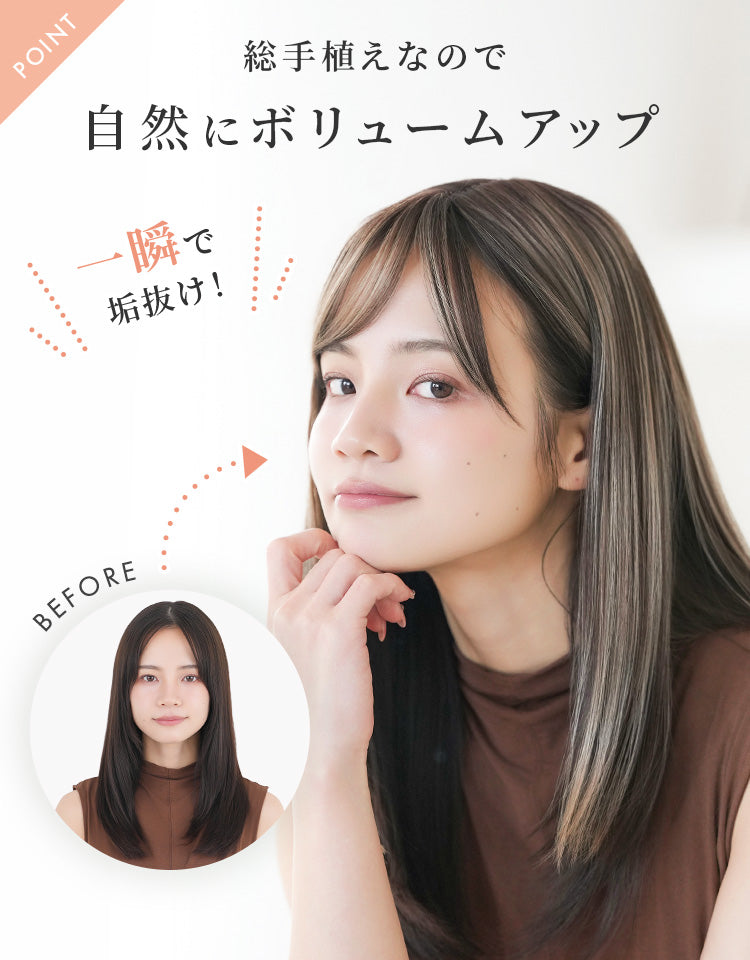 トップエクステンション